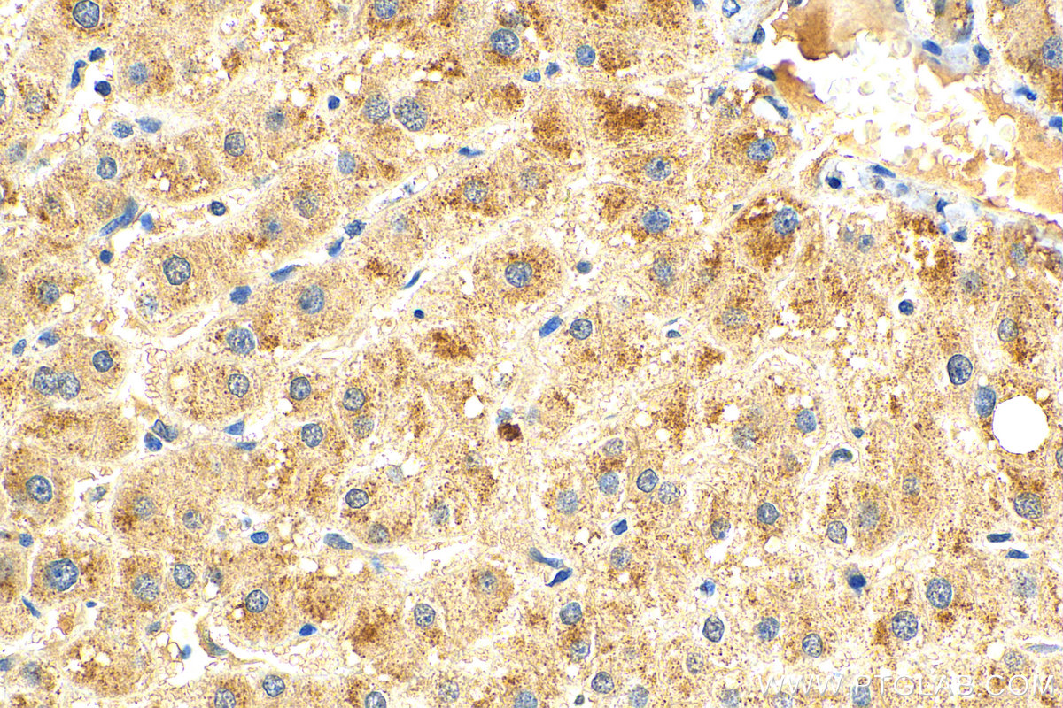 IHC staining of human liver using 27801-1-AP