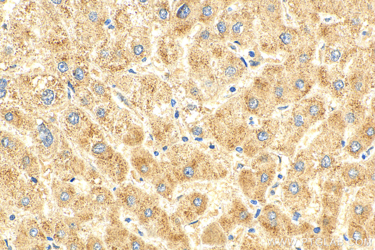 IHC staining of human liver using 27801-1-AP
