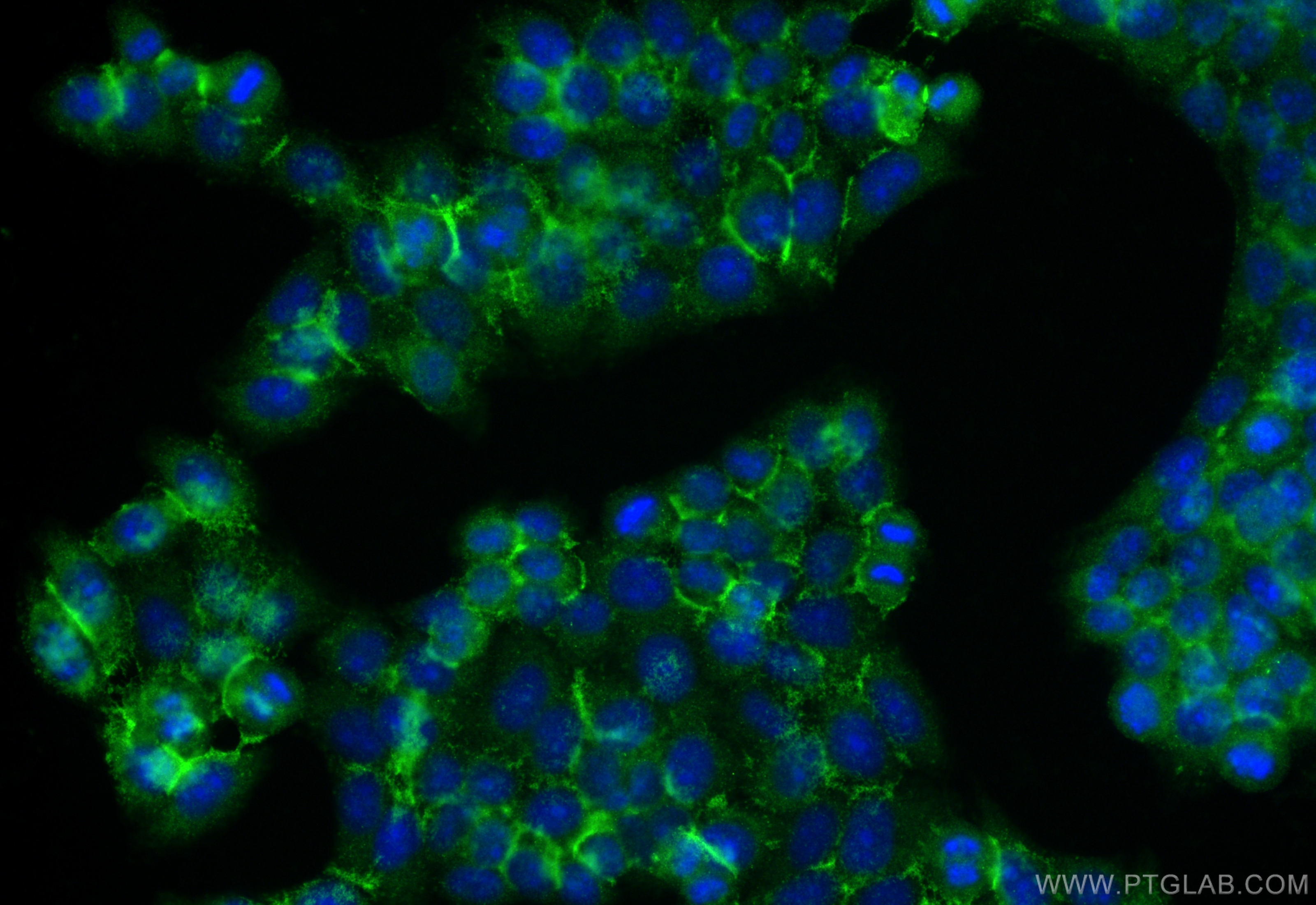 IF Staining of L02 using 10670-1-AP
