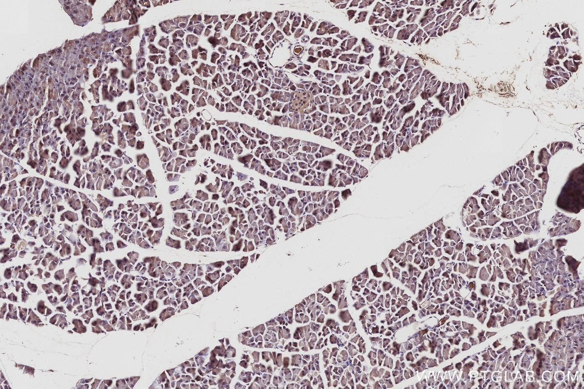 IHC staining of mouse pancreas using 10670-1-AP IHC staining of mouse pancreas using 10670-1-AP