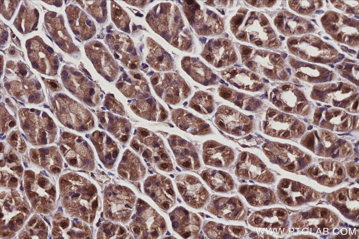 IHC staining of mouse stomach using 10670-1-AP IHC staining of mouse stomach using 10670-1-AP