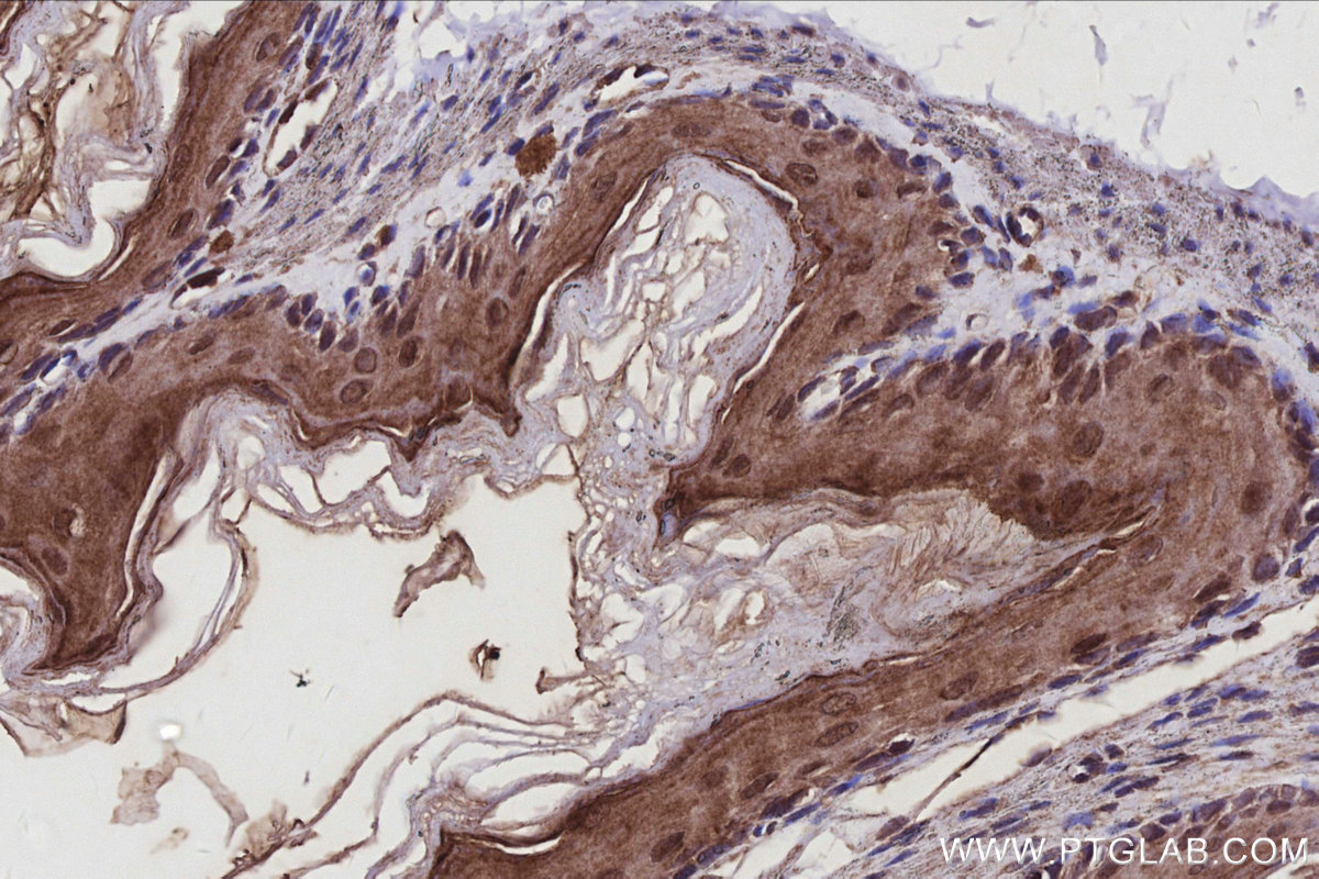 IHC staining of mouse stomach using 10670-1-AP IHC staining of mouse stomach using 10670-1-AP