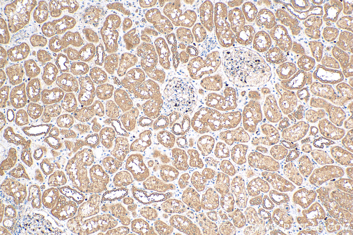 IHC staining of human kidney using 17096-1-AP