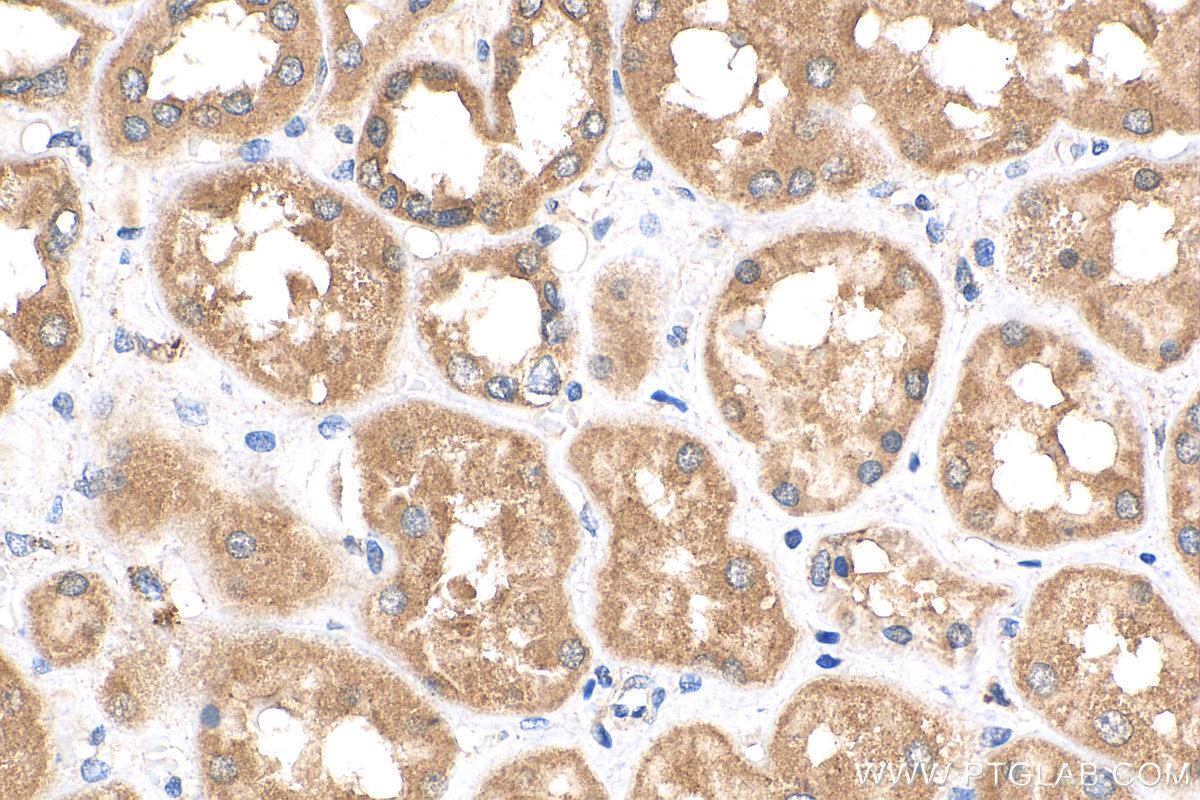 IHC staining of human kidney using 17096-1-AP