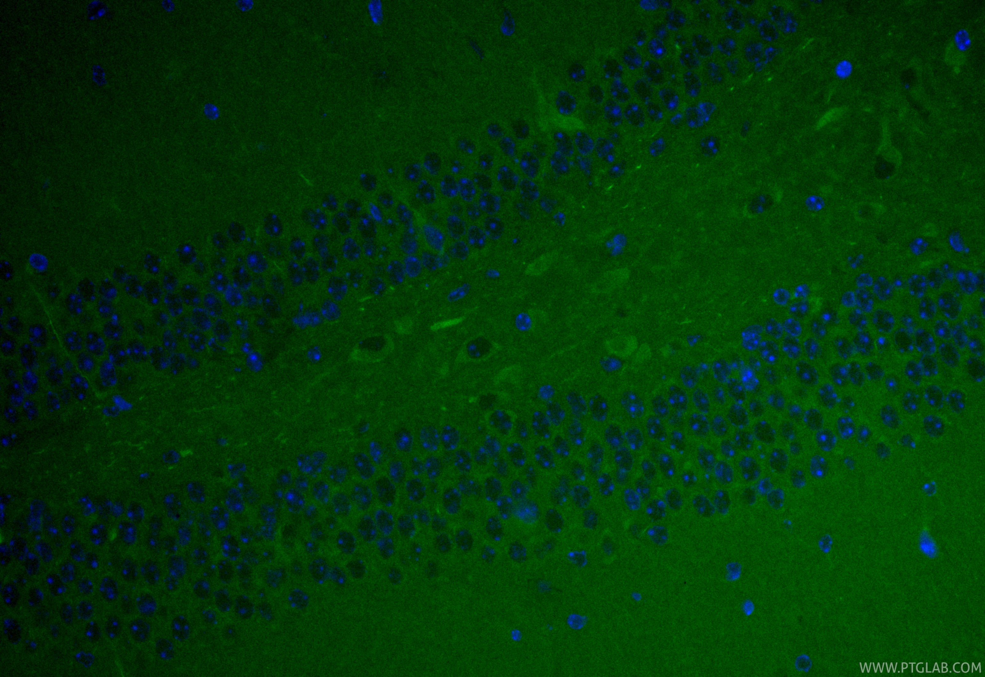IF Staining of mouse brain using CL488-17096 IF Staining of mouse brain using CL488-17096