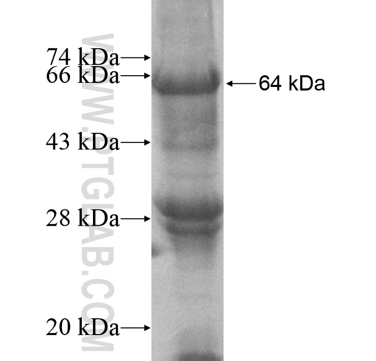 SPHK2 fusion protein Ag10569 SDS-PAGE