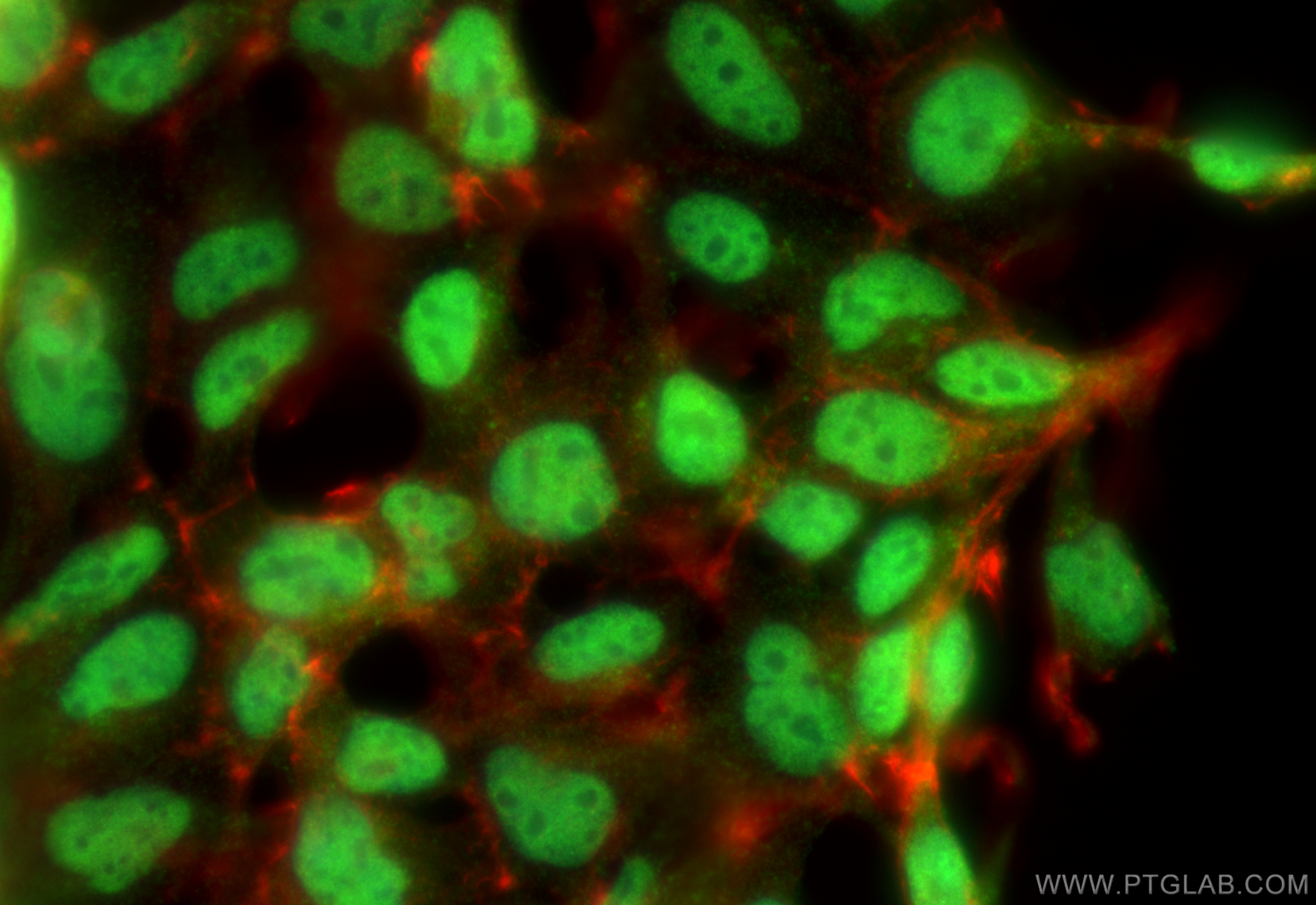 IF Staining of HEK-293 using 12105-1-AP