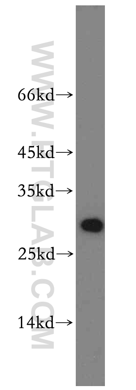 WB analysis of SKOV-3 using 19531-1-AP