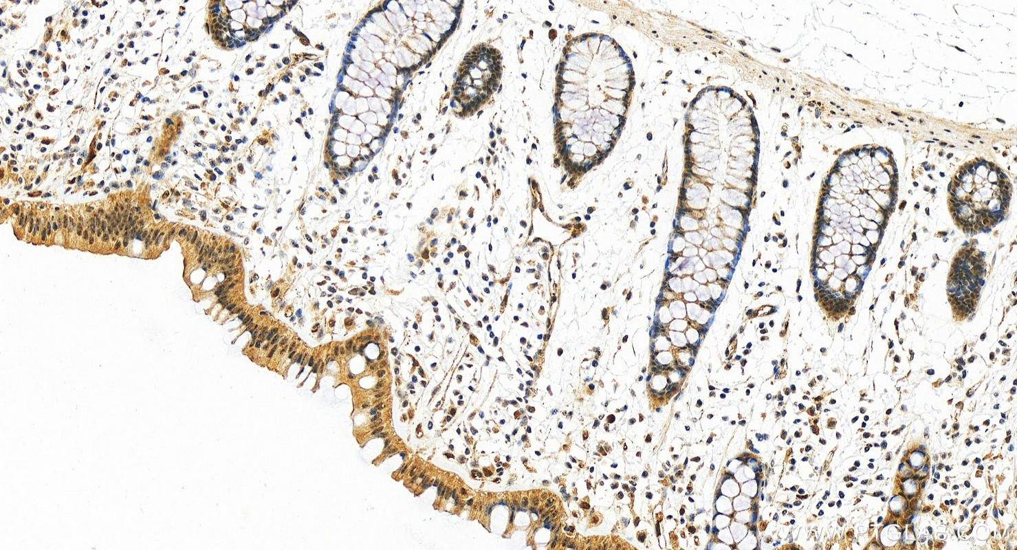 IHC staining of human colon using 10107-2-AP