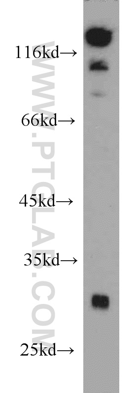 WB analysis of mouse brain using 10107-2-AP