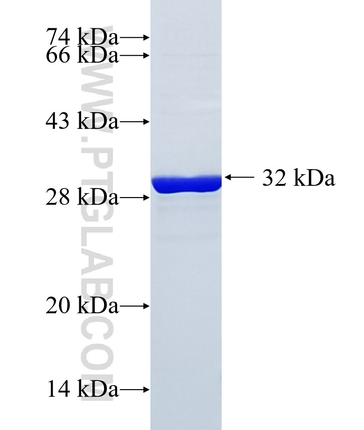 SPIN4 fusion protein Ag16484 SDS-PAGE SPIN4 fusion protein Ag16484 SDS-PAGE