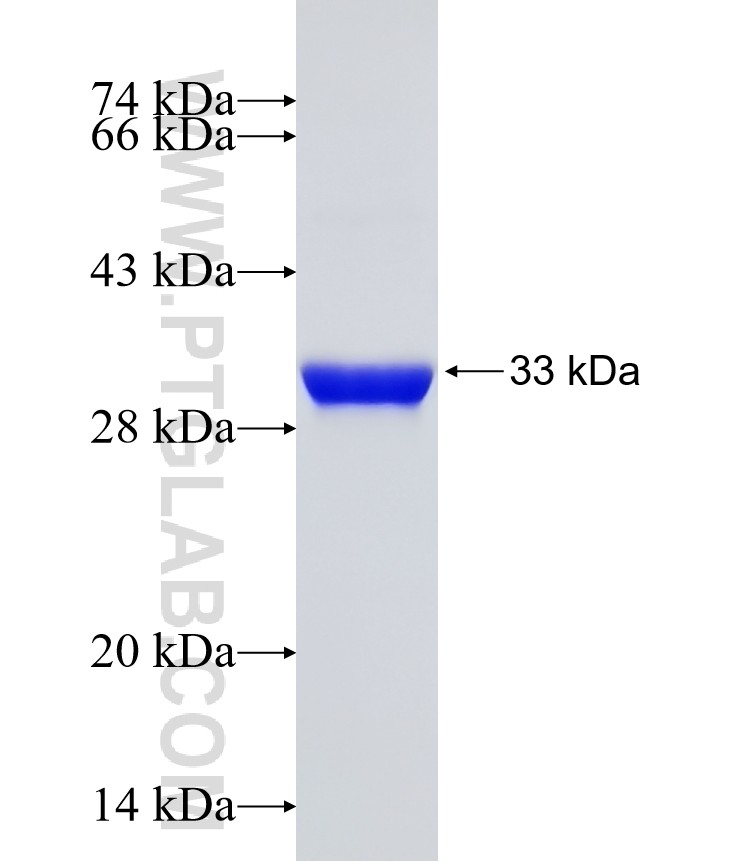 SPINK1 fusion protein Ag17131 SDS-PAGE SPINK1 fusion protein Ag17131 SDS-PAGE