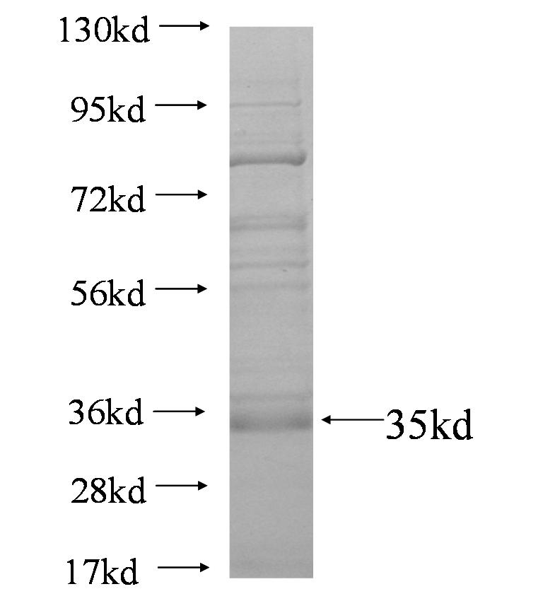 SPINK1 fusion protein Ag4344 SDS-PAGE SPINK1 fusion protein Ag4344 SDS-PAGE