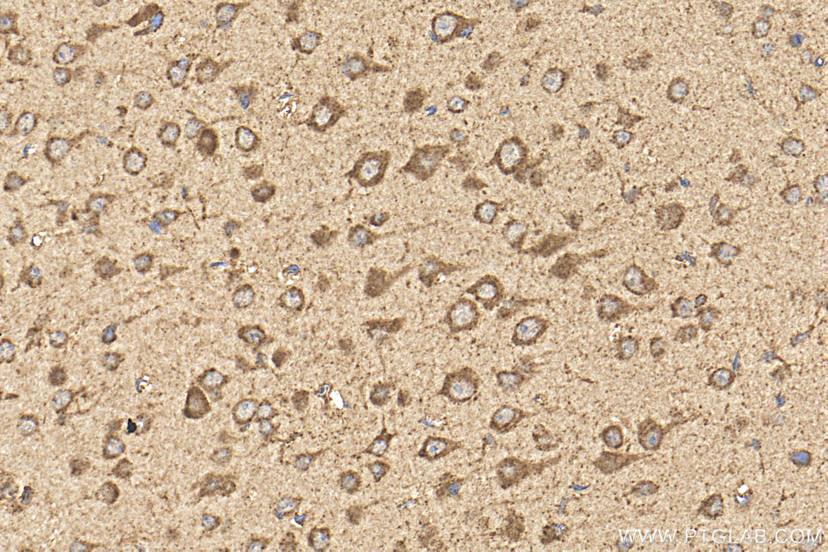 IHC staining of mouse brain using 24656-1-AP IHC staining of mouse brain using 24656-1-AP