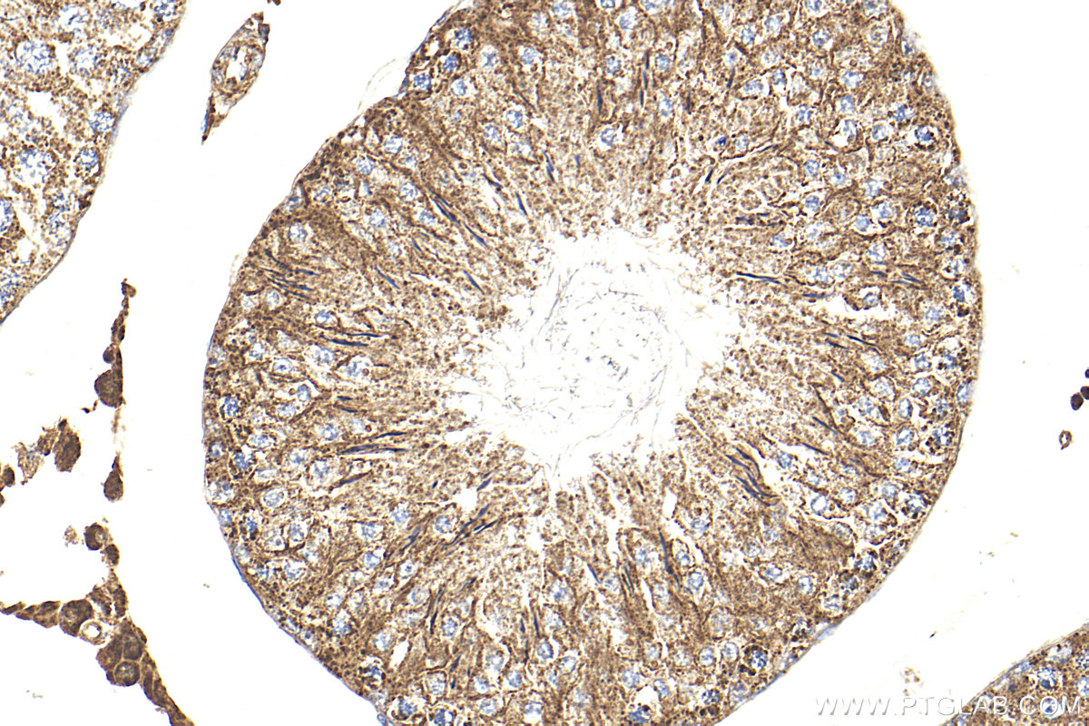 IHC staining of rat testis using 24656-1-AP IHC staining of rat testis using 24656-1-AP