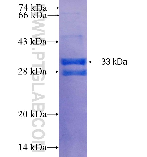 SPINK6 fusion protein Ag11392 SDS-PAGE
