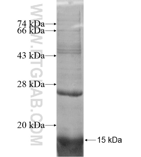 SPINK6 fusion protein Ag11417 SDS-PAGE SPINK6 fusion protein Ag11417 SDS-PAGE