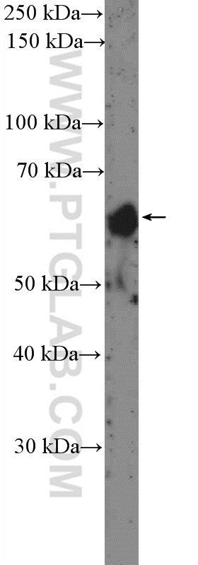 WB analysis of human placenta using 15036-1-AP