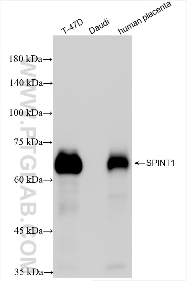 WB analysis using 86138-1-RR