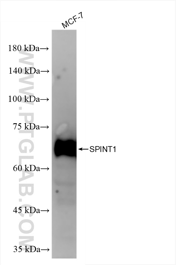 WB analysis of MCF-7 using 86138-1-RR