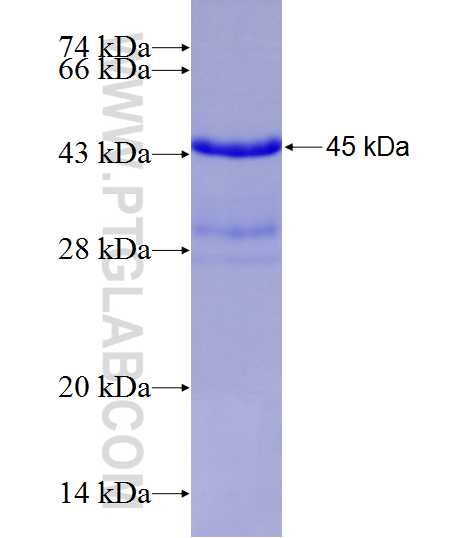 SPINT2 fusion protein Ag14950 SDS-PAGE SPINT2 fusion protein Ag14950 SDS-PAGE