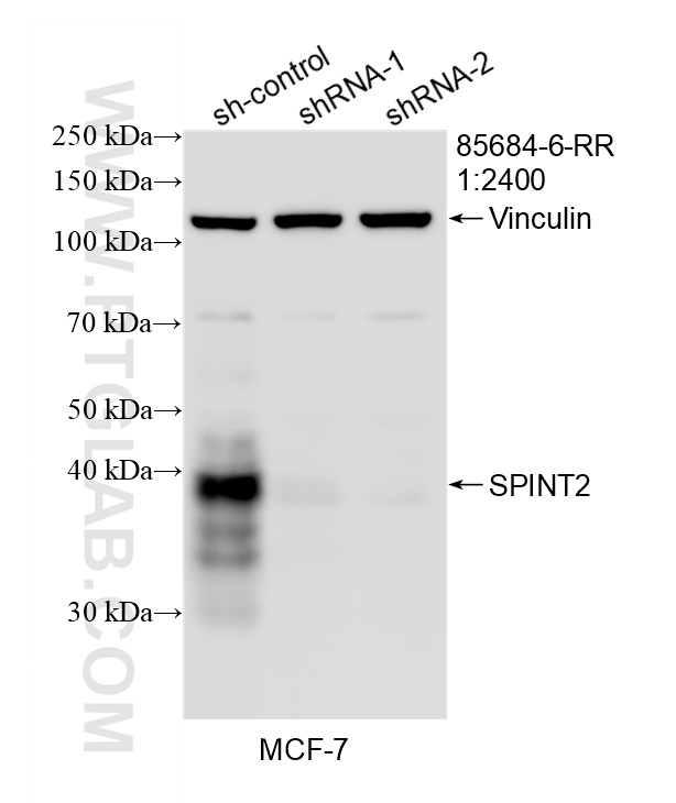 WB analysis of MCF-7 using 85684-6-RR