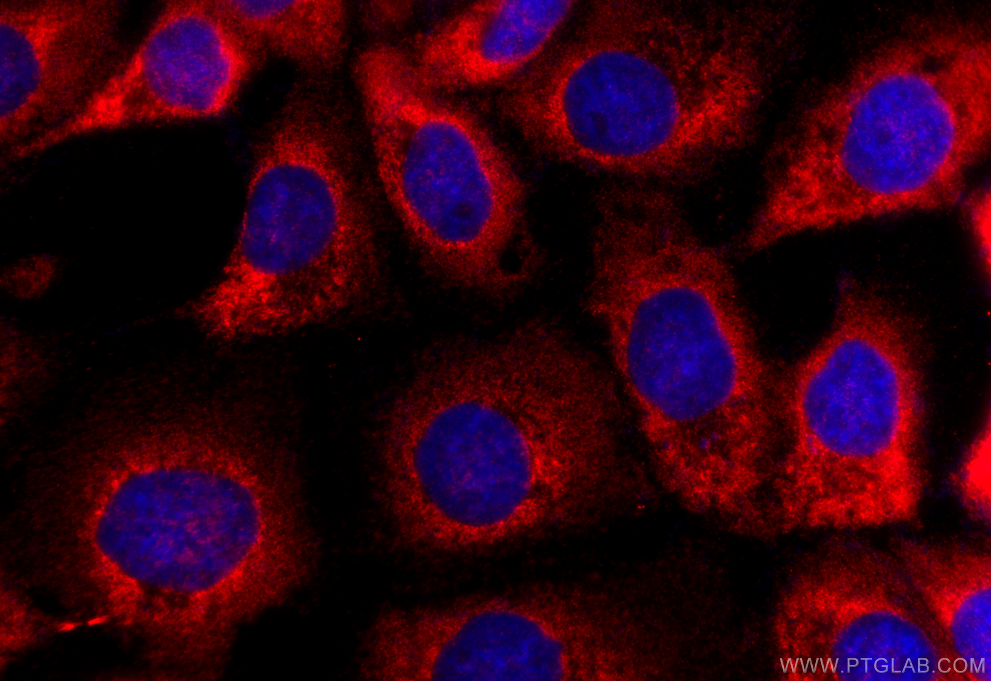 IF Staining of A431 using 31931-1-AP