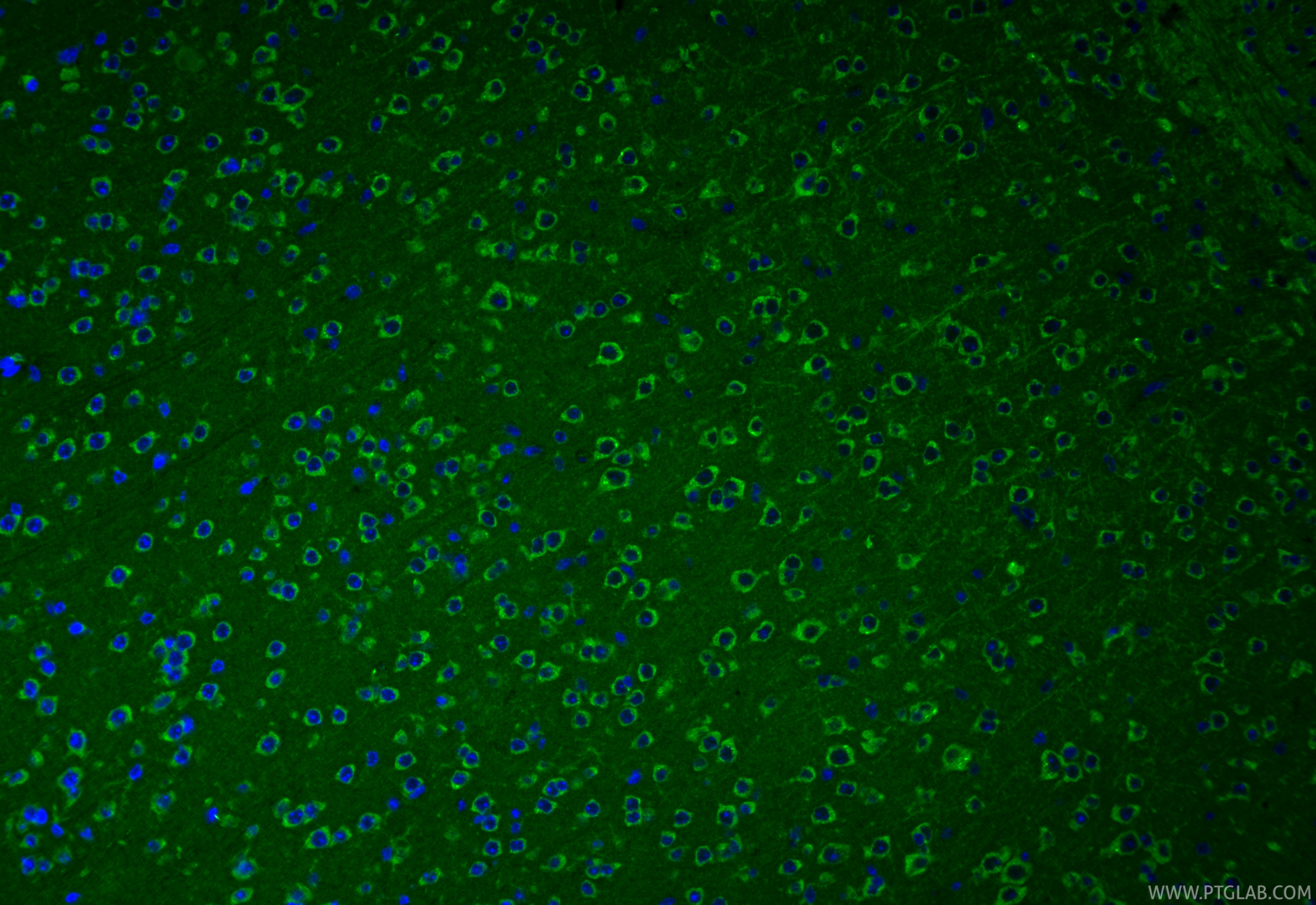 IF Staining of mouse brain using 11295-1-AP