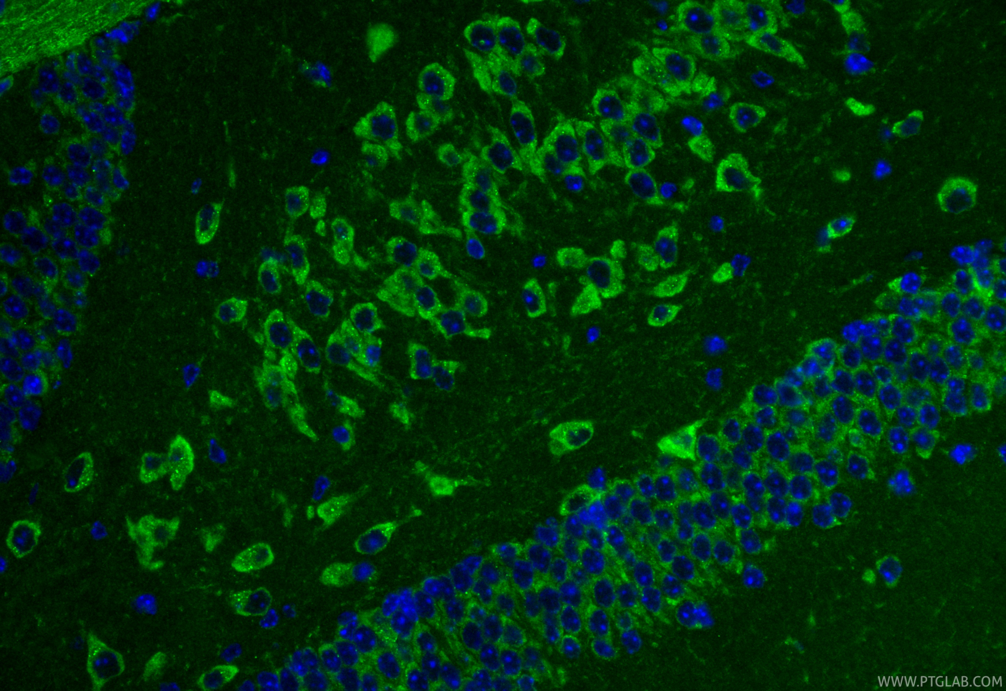 IF Staining of mouse brain using 11295-1-AP