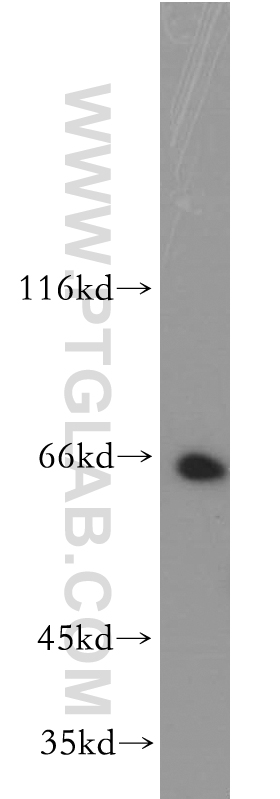 WB analysis of K-562 using 13959-1-AP