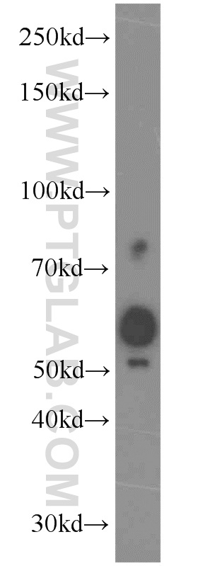 WB analysis of mouse testis using 15509-1-AP (same clone as 15509-1-PBS)