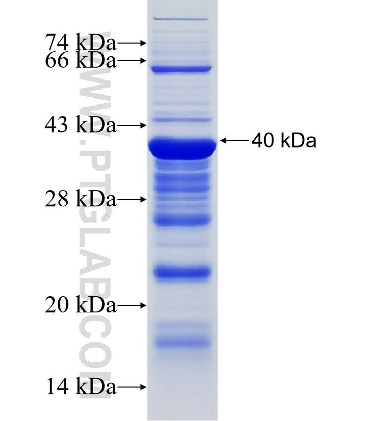 SPOCD1 fusion protein Ag17734 SDS-PAGE