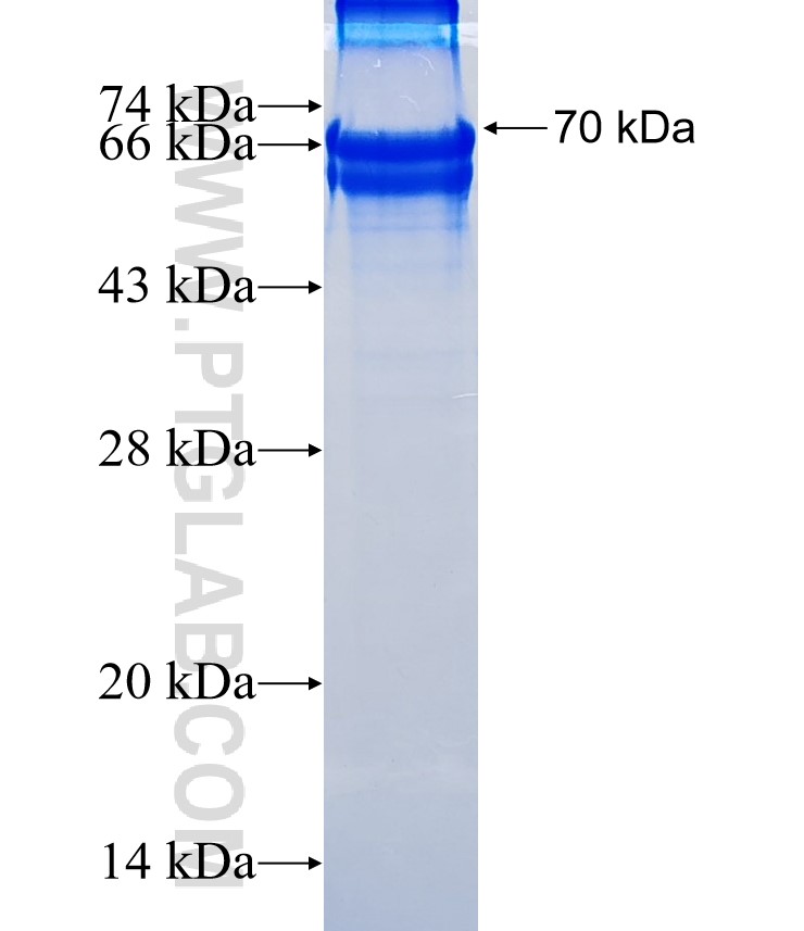 SPON1 fusion protein Ag16260 SDS-PAGE SPON1 fusion protein Ag16260 SDS-PAGE