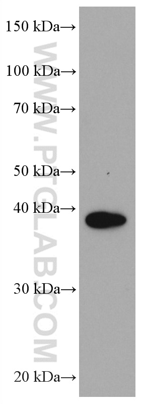 WB analysis of LNCaP using 66859-1-Ig