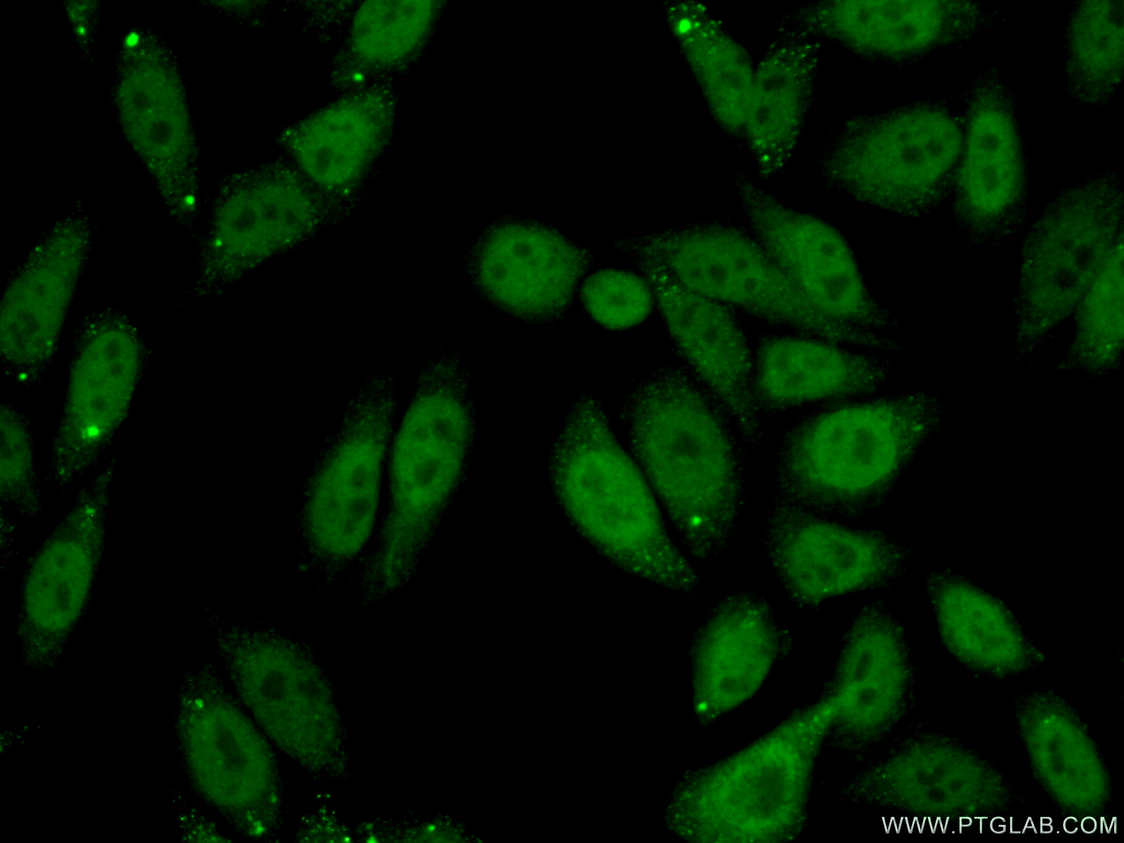 IF Staining of HepG2 using 16750-1-AP