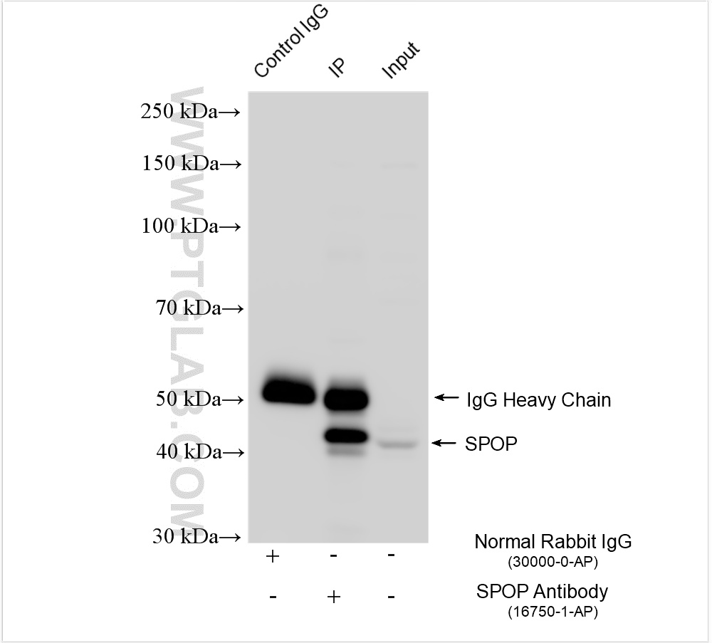 IP experiment of HepG2 using 16750-1-AP