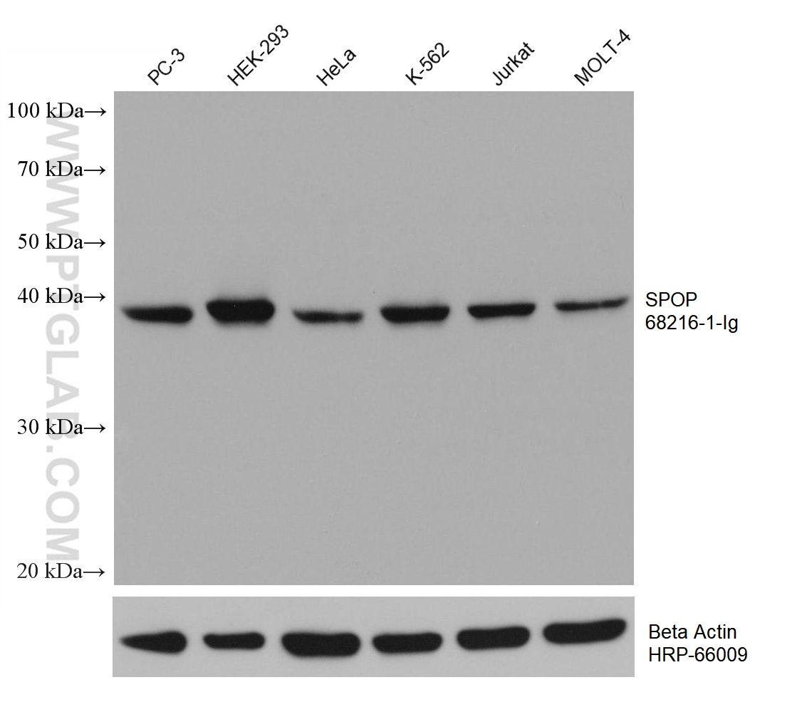 WB analysis using 68216-1-Ig