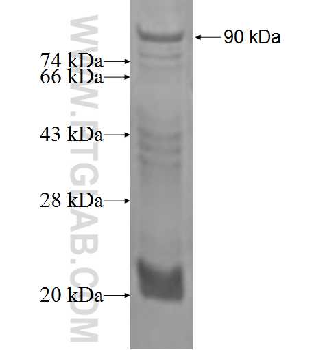 OPN, SPP1 fusion protein Ag1086 SDS-PAGE OPN, SPP1 fusion protein Ag1086 SDS-PAGE