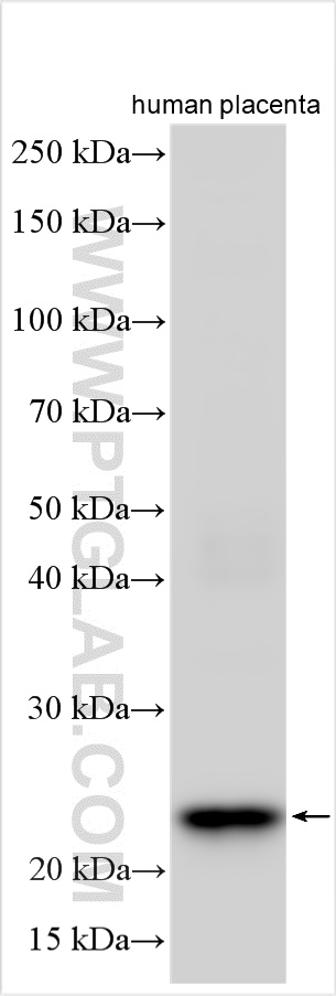 WB analysis using 30922-1-AP