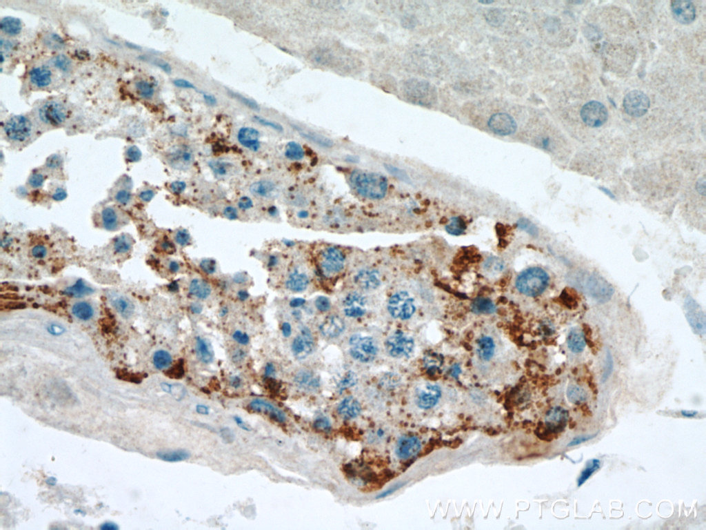 IHC staining of human testis using 13255-1-AP