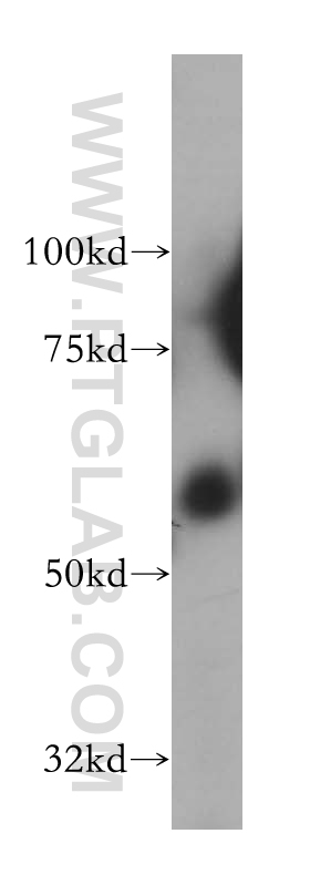 WB analysis of human colon using 13255-1-AP