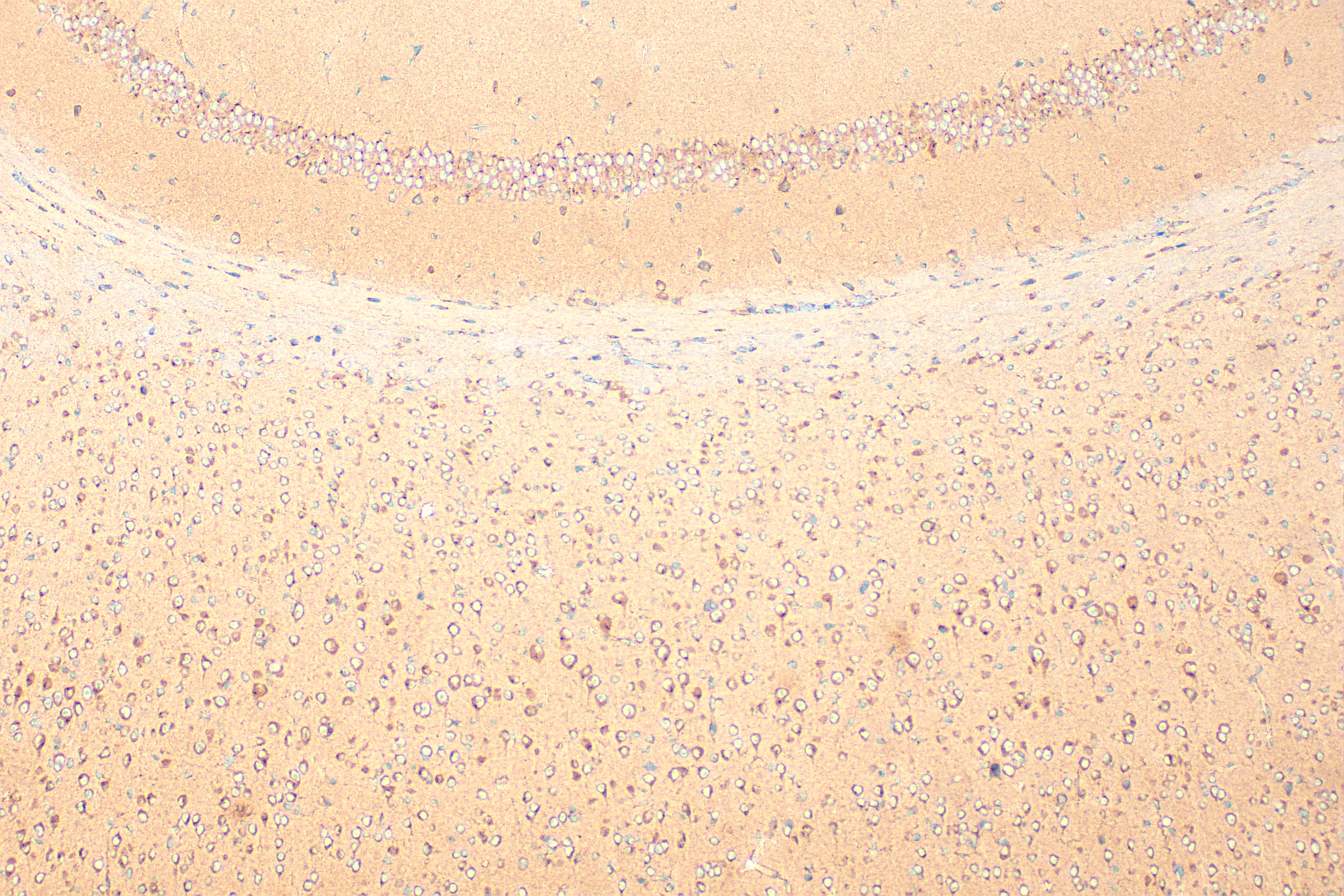 IHC staining of mouse brain using 27370-1-AP IHC staining of mouse brain using 27370-1-AP