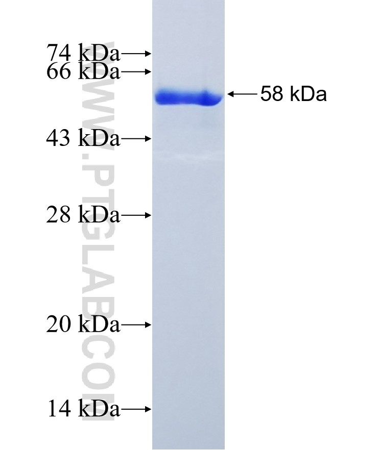 SPR fusion protein Ag10395 SDS-PAGE