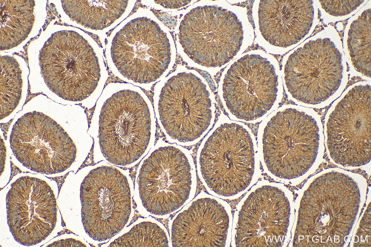 IHC staining of rat testis using 24091-1-AP