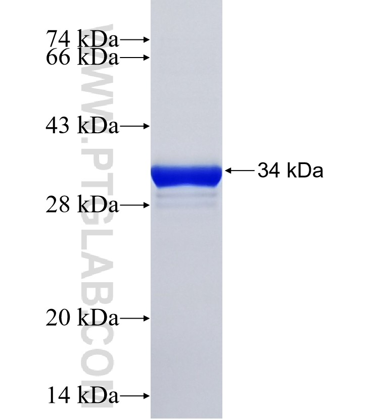 SPRR2E fusion protein Ag20299 SDS-PAGE