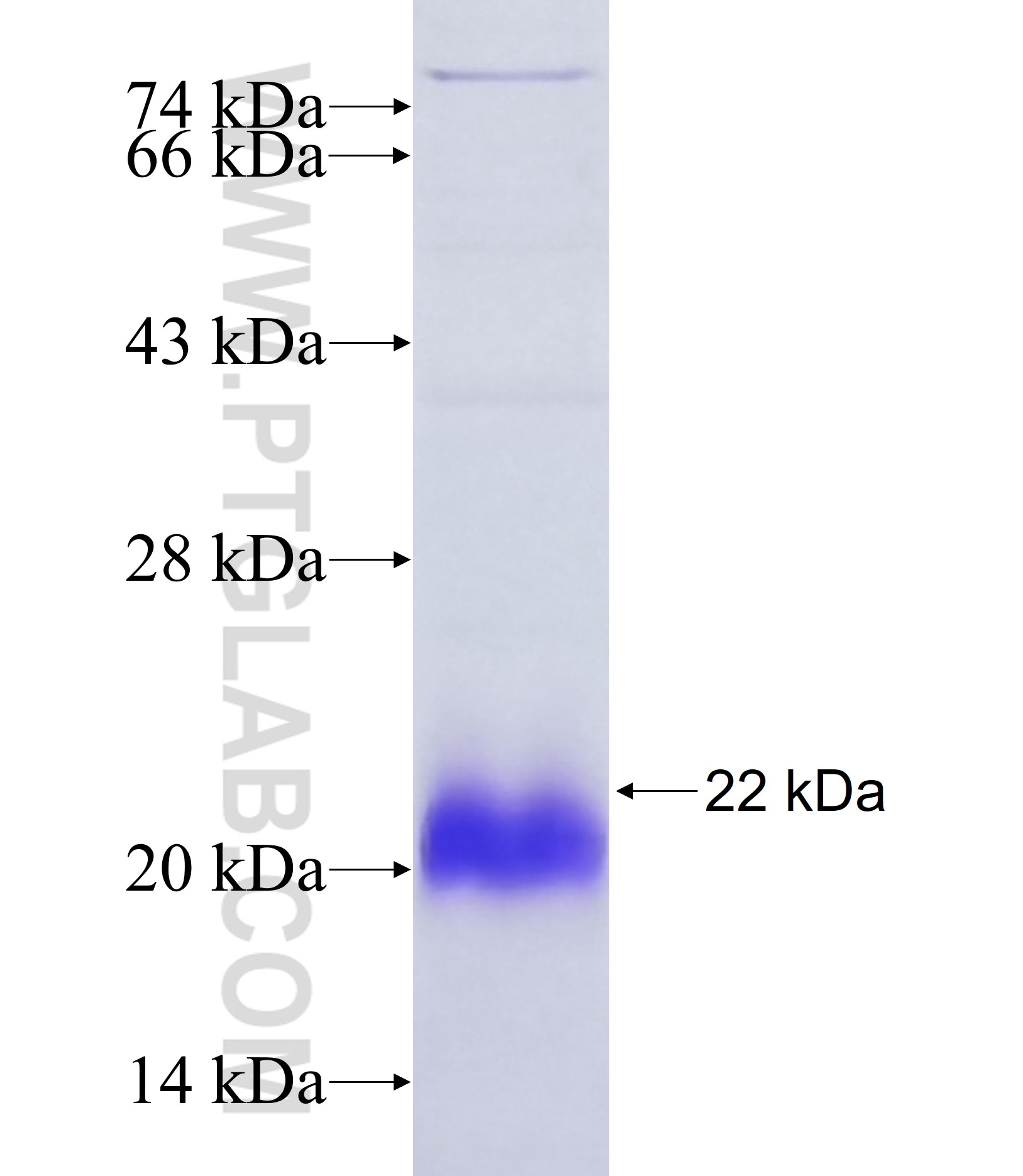SPRR2G fusion protein Ag38037 SDS-PAGE SPRR2G fusion protein Ag38037 SDS-PAGE