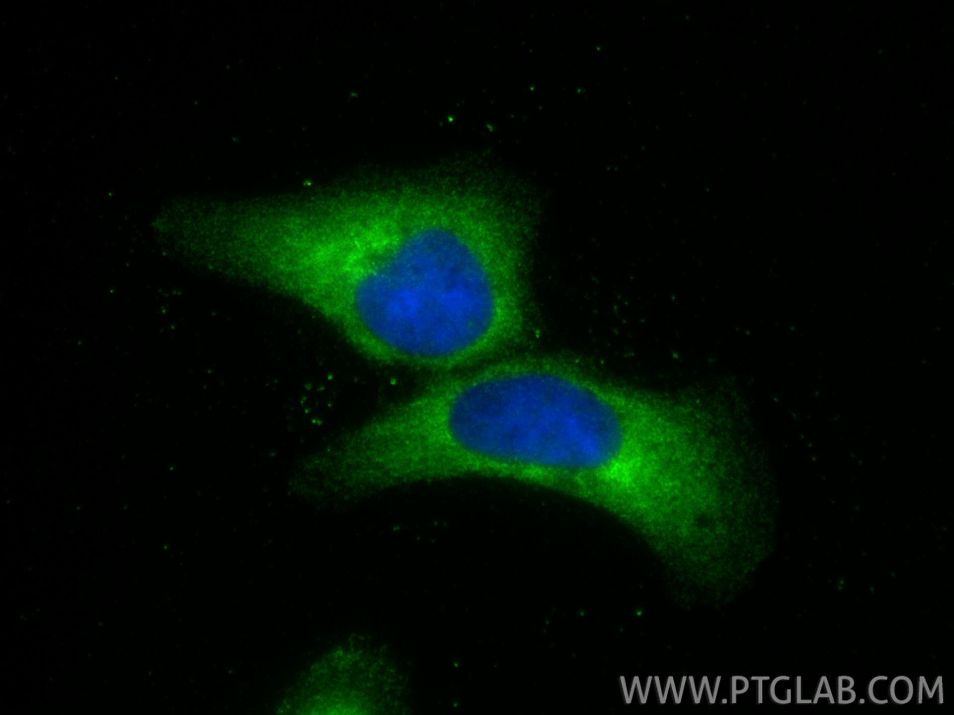 IF Staining of A431 using 11742-1-AP IF Staining of A431 using 11742-1-AP