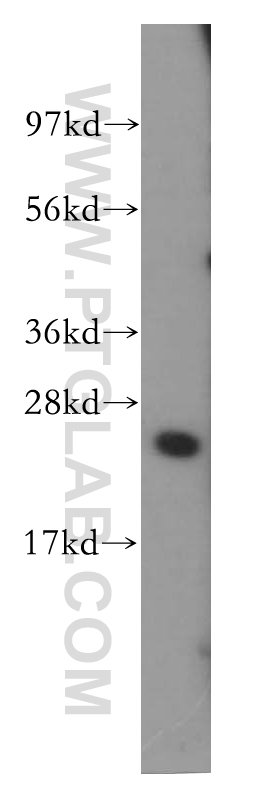 WB analysis of HeLa using 11742-1-AP