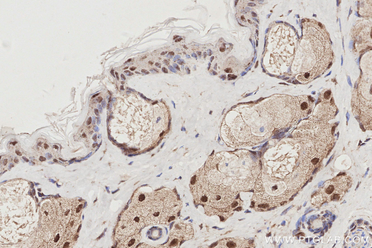 IHC staining of mouse skin using 24850-1-AP (same clone as 24850-1-PBS) IHC staining of mouse skin using 24850-1-AP (same clone as 24850-1-PBS)