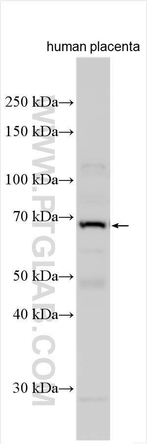 WB analysis of human placenta using 24850-1-AP